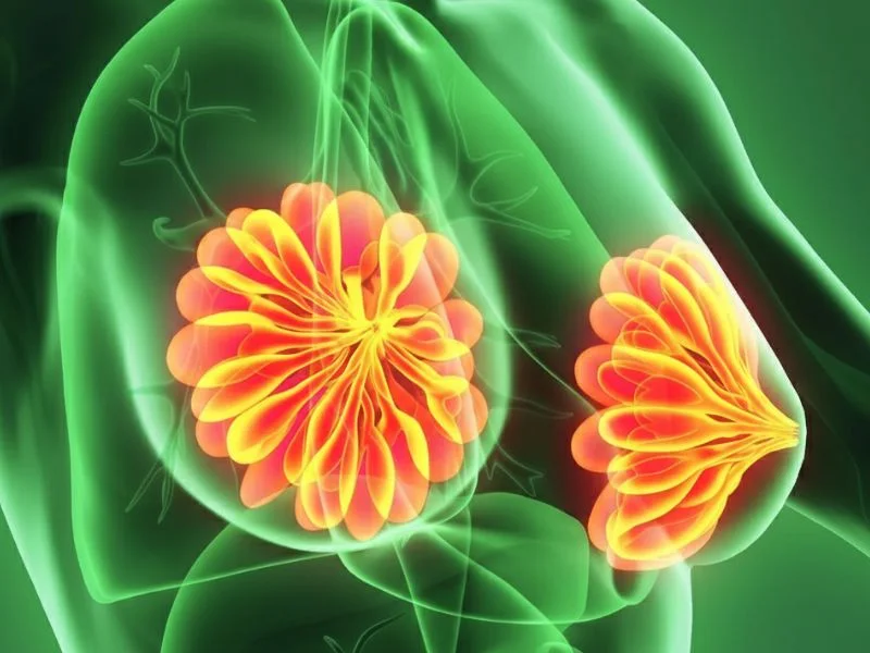 Årsager til brystbetændelse